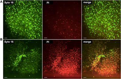 The Predictive Value of Graft Viability and Bioenergetics Testing Towards the Outcome in Liver Transplantation